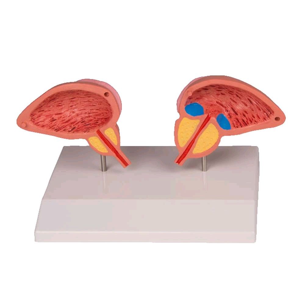 Erler Zimmer anatomisches Prostata Modell, 2-teilig, 3/4 Größe