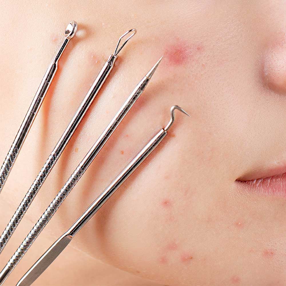 Kai Medical Einweg Hautkürette, einseitig scharf, präzise, 2mm, 1St