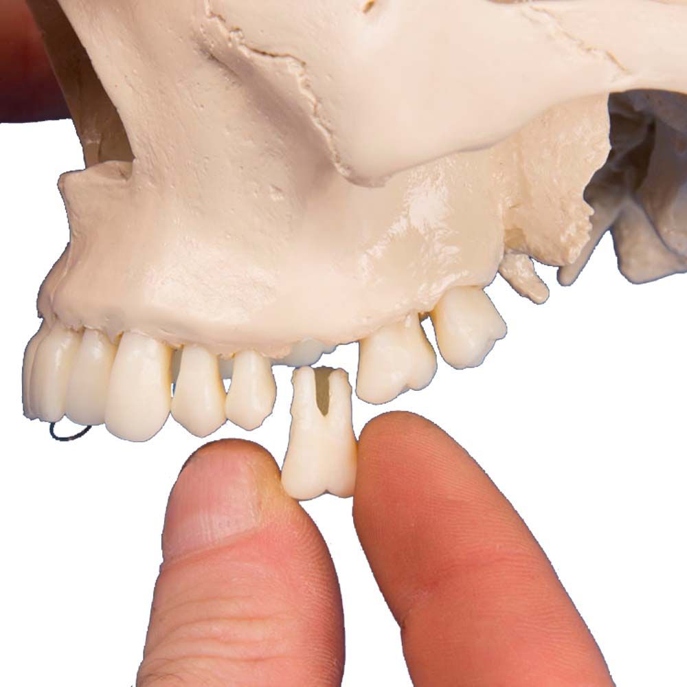 Erler Zimmer Dental-Schädelmodell, 4-teilig