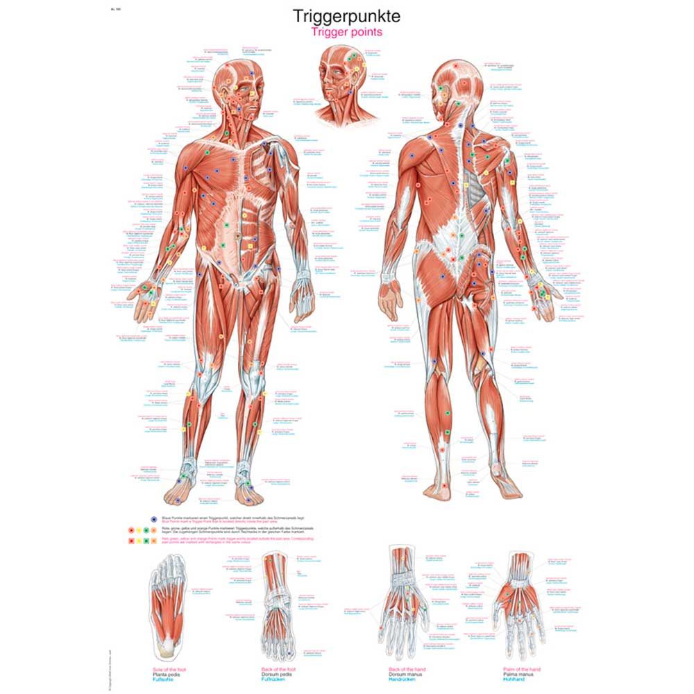 Erler Zimmer anatomische Lehrtafel - "Triggerpunkte", 2 Größen