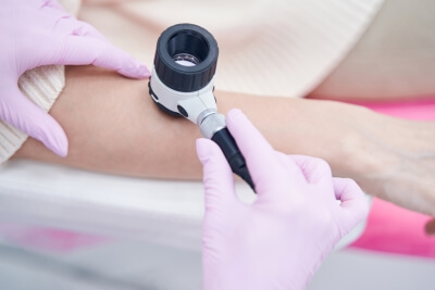 Ein Arzt nutzt das Dermatoskop zur Hautuntersuchung