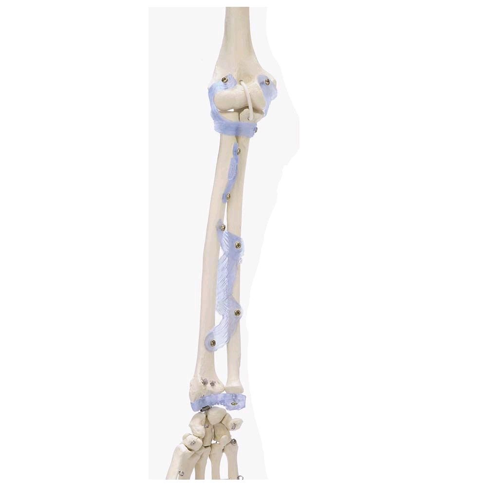 Ganzkörper Skelett anatomisch 1,76cm, Skelett Otto mit Bandapparat