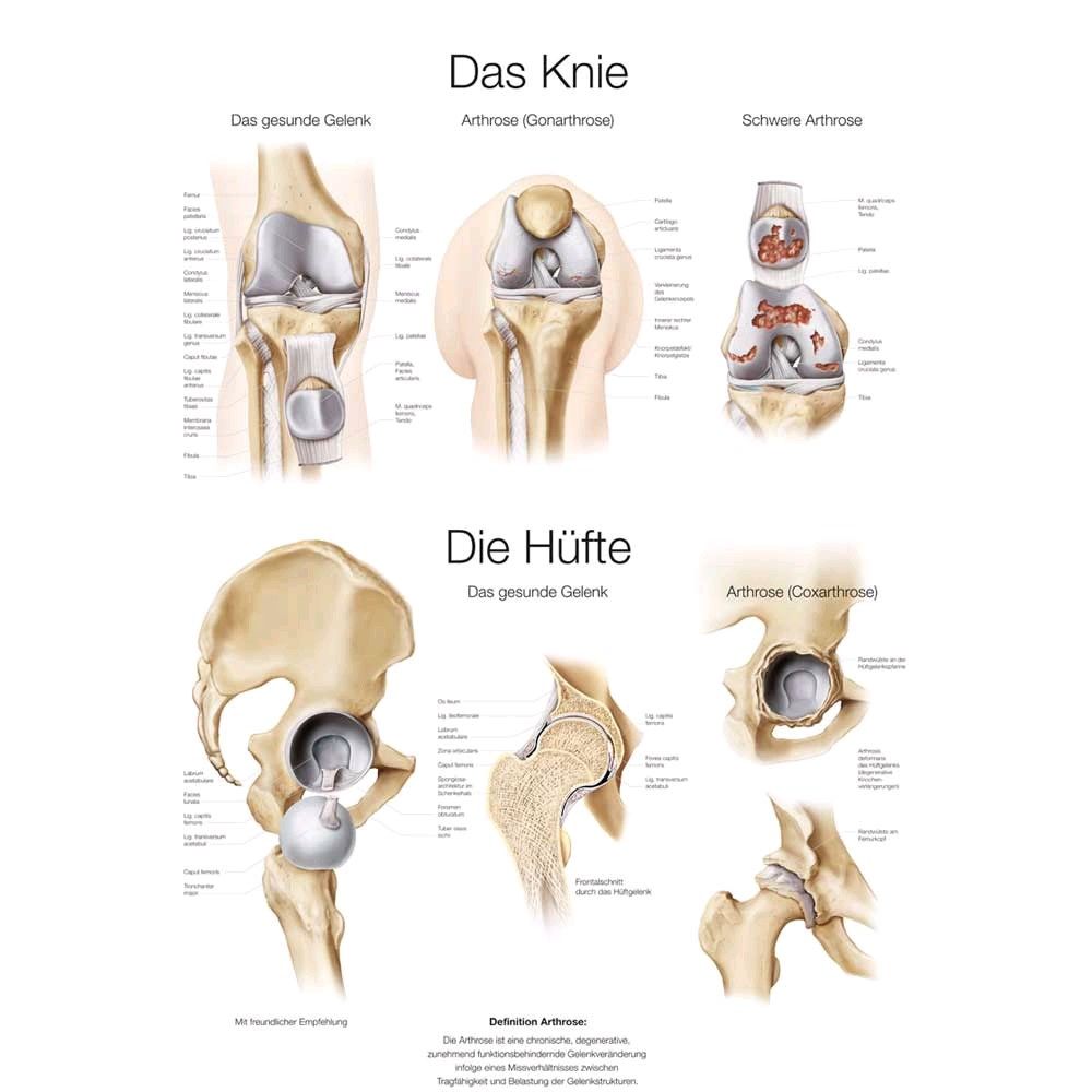 Erler Zimmer Lehrtafel Das Knie / Die Hüfte, 50x70 cm, Kunstdruck