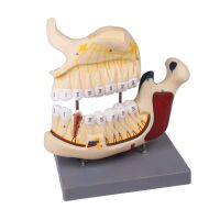 Ober- und Unterkiefermodell von Erler Zimmer, nummeriert,...