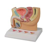 Erler Zimmer Beckenschnitt Modell Prostataerkrankungen,...